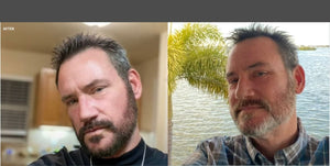 Rods Major Transformation