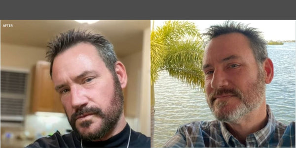 Rods Major Transformation